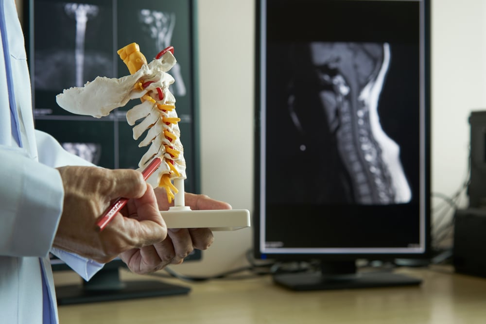 Doctor pointing to spine anatomy model with xrays in background.