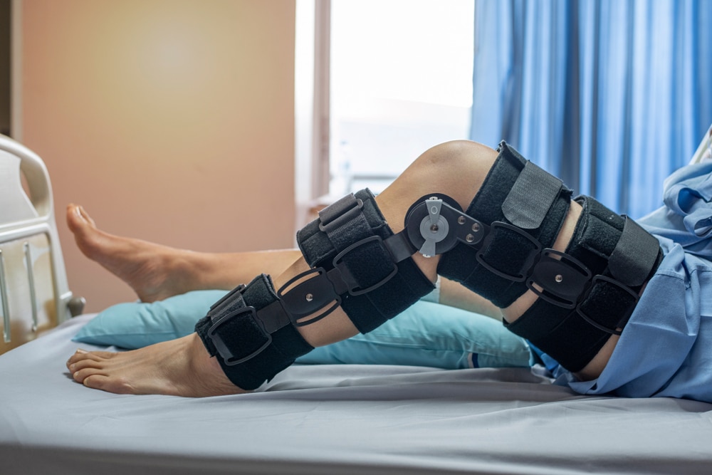 Patient's leg in a hinged knee brace after ACL surgery, resting on a hospital bed and beginning recovery.